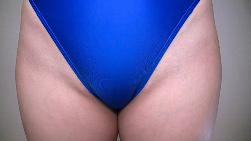 Sample 19