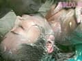 Sample 25