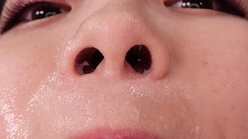 Sample 20