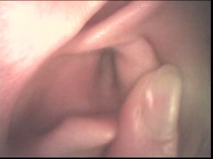 Sample 14