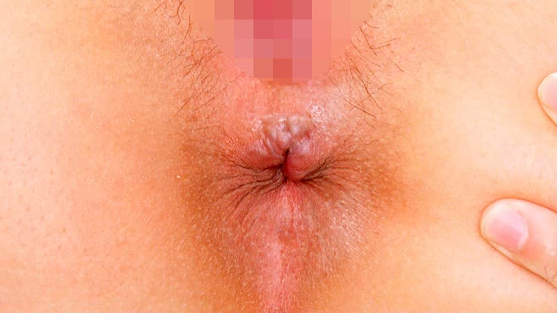 Sample 20