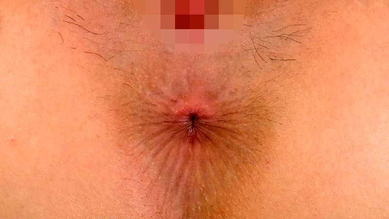 Sample 5