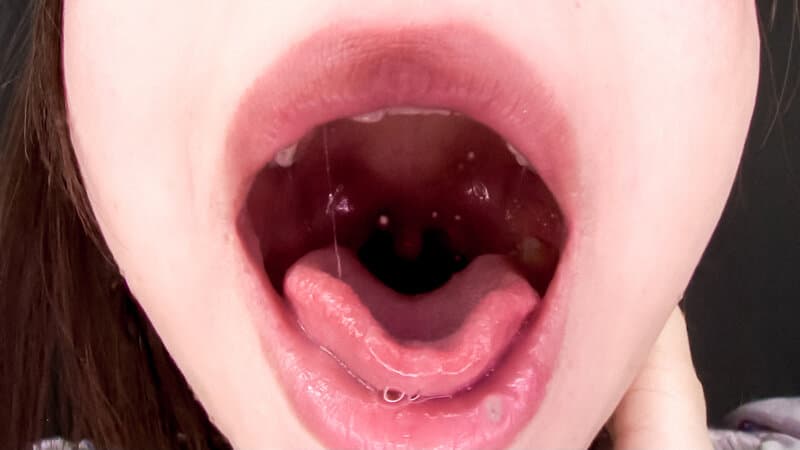 Sample 15
