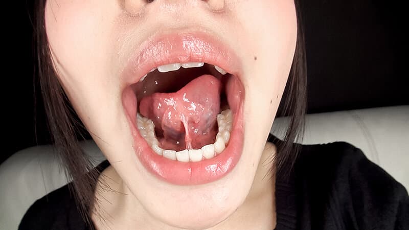 Sample 18