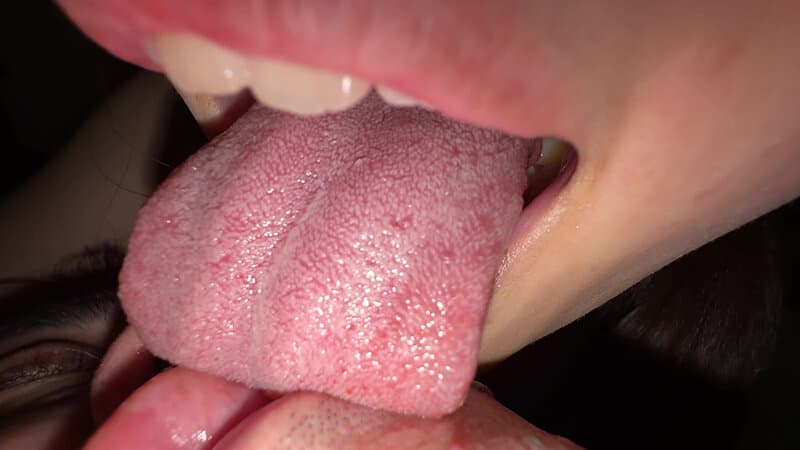 Sample 15