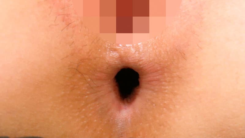 Sample 4