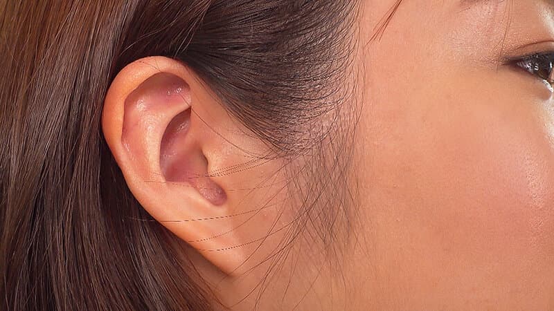 Sample 4