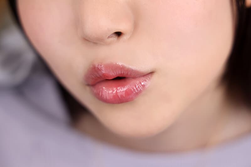 Sample 18